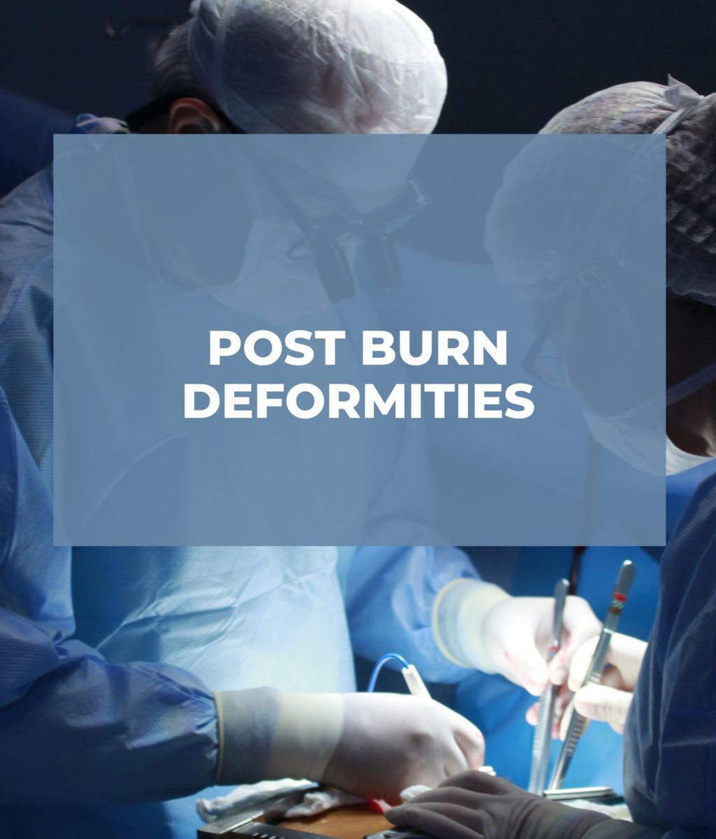 Post Burn deformities Post Burn deformities